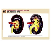 Рельефная таблица "Почка. Фронтальный разрез" (формат А1, матовое ламинир.) - «globural.ru» - Минусинск
